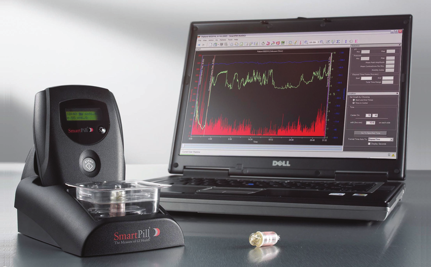 GI Monitor System